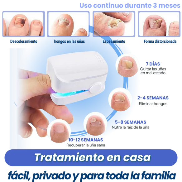 NailPro™-despídete del hongo y recupera el brillo natural de tus uñas.