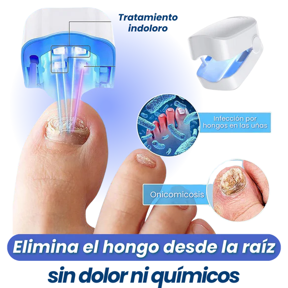 NailPro™-despídete del hongo y recupera el brillo natural de tus uñas.